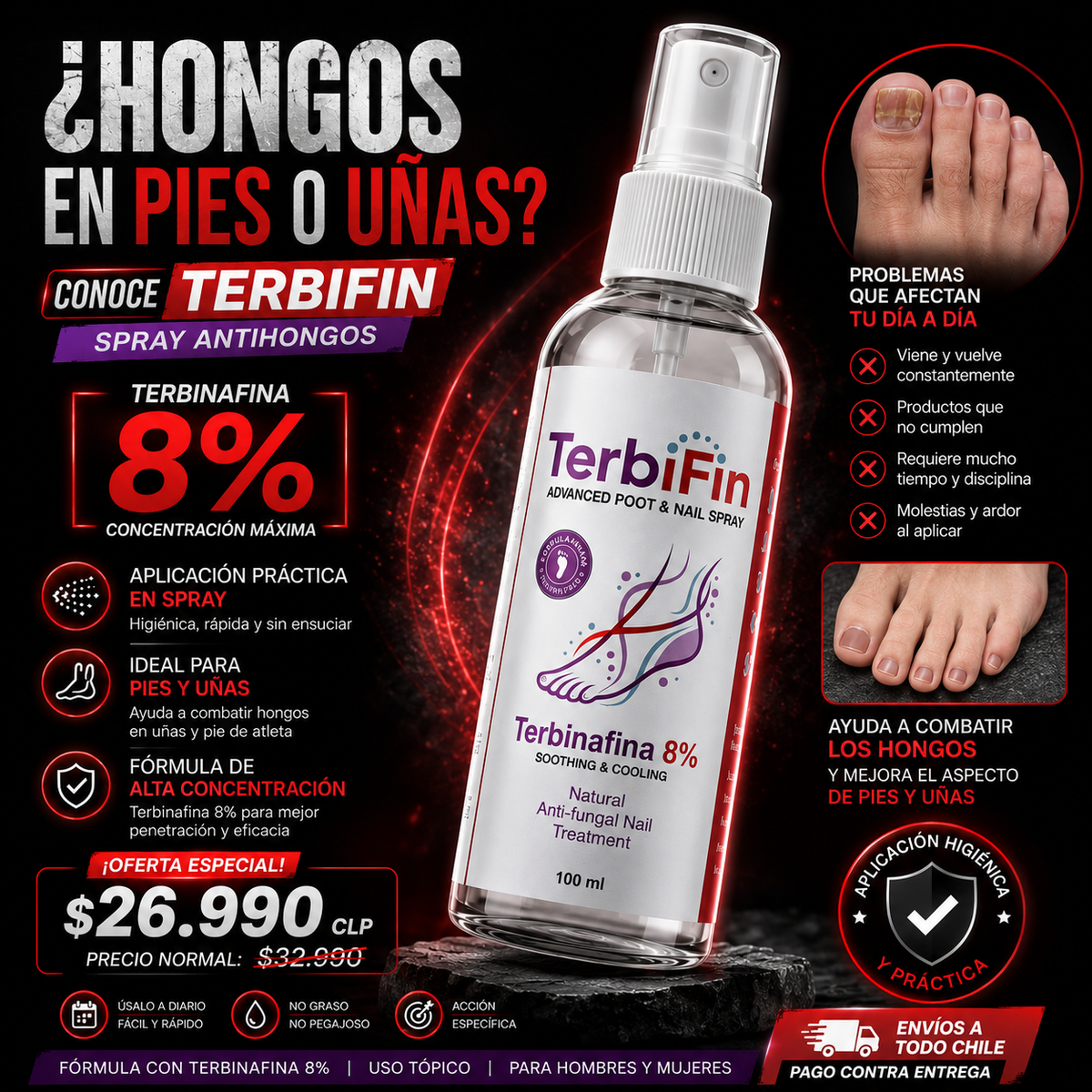 TERBIFIN - SPRAY ANTIHONGOS MÁXIMA POTENCIA